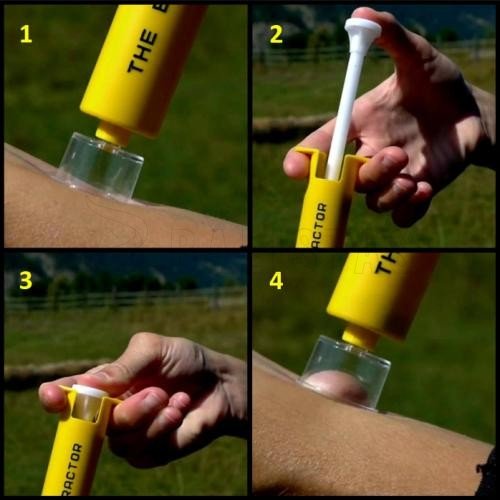 Sawyer Bite & Sting Kit harapás elleni készlet